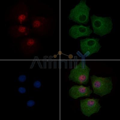 Phospho-PAR4 (Thr163) Antibody - AF4485 staining Hela cells(4h of LPS treatment) by IF/ICC.