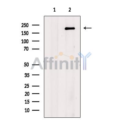 Tuberin/TSC2 Antibody - Western blot analysis of extracts from Hela cells, using Tuberin/TSC2 Antibody.