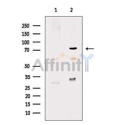 IRAK1 Antibody - Western blot analysis of extracts from A2780 cells, using IRAK1 Antibody.