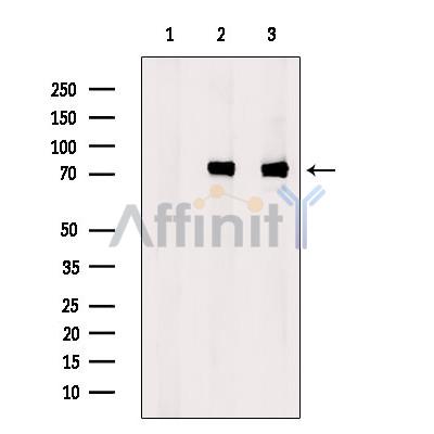 BMX Antibody - Western blot analysis of extracts from various samples, using Etk Antibody.