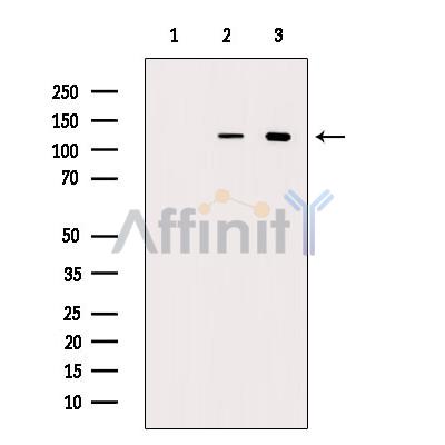 Eg5 Antibody - Western blot analysis of extracts from various samples, using KIF11/Eg5 Antibody.