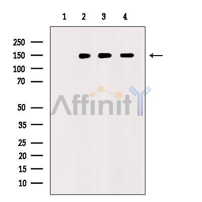 BACH1/BRIP1 Antibody - Western blot analysis of extracts from various samples, using BACH1/BRIP1 Antibody.