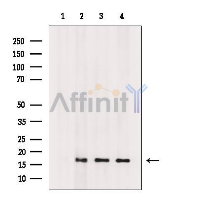 TNF alpha Antibody - Western blot analysis of extracts from various samples, using TNFA Antibody.