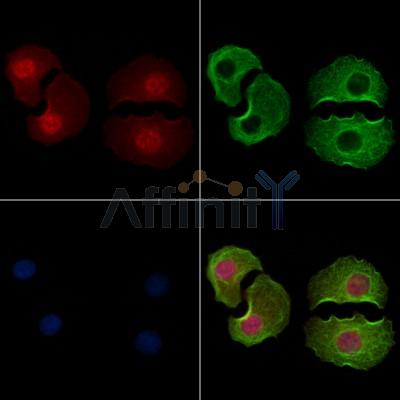 Phospho-CRYAB (Ser19) Antibody - AF7176 staining Hela cells(4h of LPS treatment) by IF/ICC.
