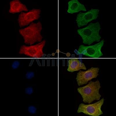 Phospho-Vimentin (Tyr117) Antibody - AF7212 staining HepG2 cells(4h of LPS treatment) by IF/ICC.