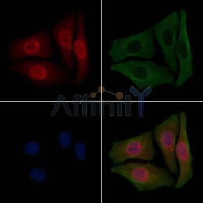 Phospho-B Raf (Ser729) Antibody - AF7232 staining Hela cells(4h of LPS treatment) by IF/ICC.