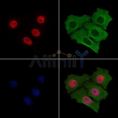 Phospho-GATA2 (Ser192) Antibody - AF7269 staining HepG2 cells(4h of LPS treatment) by IF/ICC.