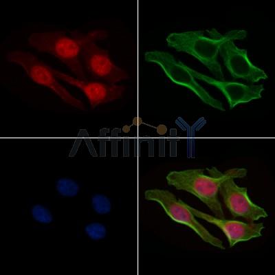 Phospho-4E-BP1 (Thr45) Antibody - AF7376 staining HepG2 cells(4h of LPS treatment) by IF/ICC.