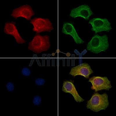 Phospho-TMEM173/STING (Ser366) Antibody - AF7416 staining HepG2 cells(4h of LPS treatment) by IF/ICC.