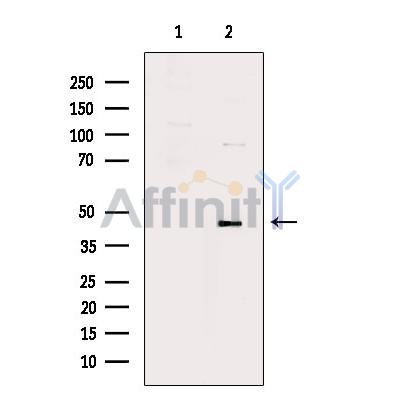 Phospho-TMEM173/STING (Ser366) Antibody - Western blot analysis of extracts from UV treated RAW264.