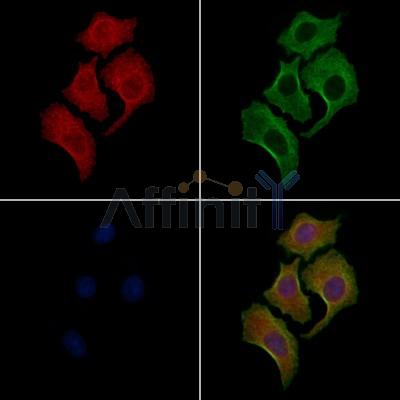 Phospho-ERK8 (Tyr177) Antibody - AF7423 staining HepG2 cells(4h of LPS treatment) by IF/ICC.