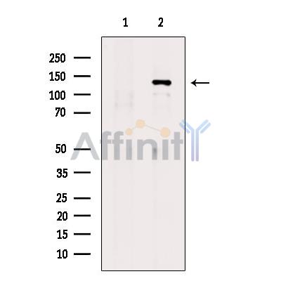 Phospho-SHIP1 (Tyr865) Antibody - Western blot analysis of extracts from serum starvation treated EC304 cells, using Phospho-SHIP1 (Tyr865) Antibody.