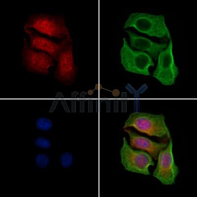 Phospho-Gli1 (Thr1074) Antibody - AF7448 staining HepG2 cells(4h of LPS treatment) by IF/ICC.