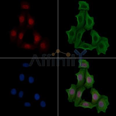 Phospho-TLK1 (Ser741) Antibody - AF8029 staining Hela cells(serum starvation) by IF/ICC.