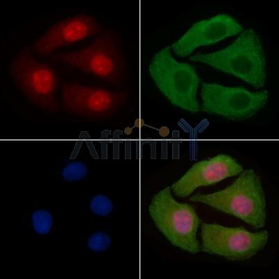 Phospho-MEK1/2 (Ser218+Ser222/Ser222+Ser226) Antibody - AF8035 staining Hela cells(4h of LPS treatment) by IF/ICC.