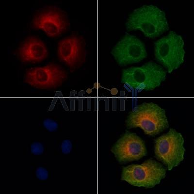 Phospho-Integrin alpha4 (Ser1027) Antibody - AF8071 staining Hela cells(4h of LPS treatment) by IF/ICC.