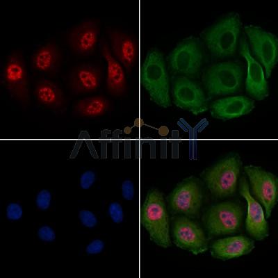 Phospho-PDX1 (Ser66) Antibody - AF8301 staining Hela cells(4h of LPS treatment) by IF/ICC.