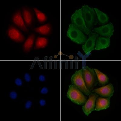 Phospho-Smad3 (Ser423+Ser425) Antibody - AF8315 staining Hela cells(4h of LPS treatment) by IF/ICC.