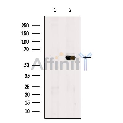FBP3 Antibody - Western blot analysis of extracts from A2780 cells, using FBP3 Antibody.