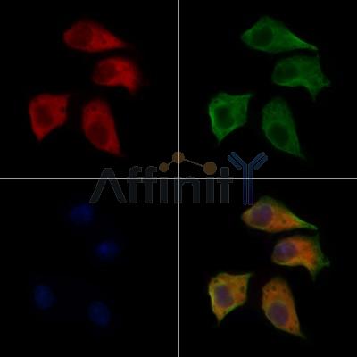 WAVE1 Antibody - AF9229 staining Hela cells by IF/ICC.
