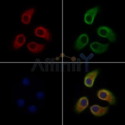ZIP2 Antibody - AF9234 staining Hela cells by IF/ICC.