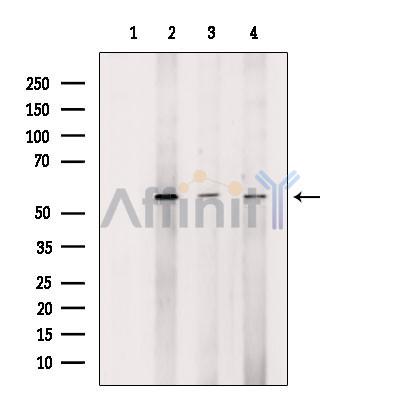 ATP6V1B2 Antibody - Western blot analysis of extracts from various samples, using ATP6V1B2 Antibody.