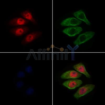 MINA Antibody - DF10071 staining Hela cells by IF/ICC.