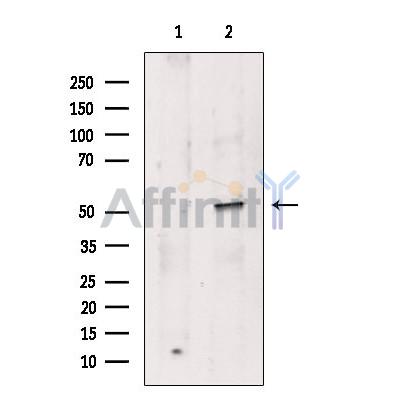 MINA Antibody - Western blot analysis of extracts from Myeloma cells, using MINA Antibody.