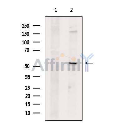 RHCG Antibody - Western blot analysis of extracts from MCF7, using RHCG Antibody.