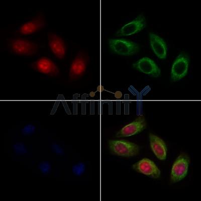 RTDR1 Antibody - DF10086 staining Hela cells by IF/ICC.