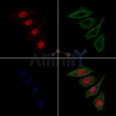MCM8 Antibody - DF10122 staining Hela cells by IF/ICC.