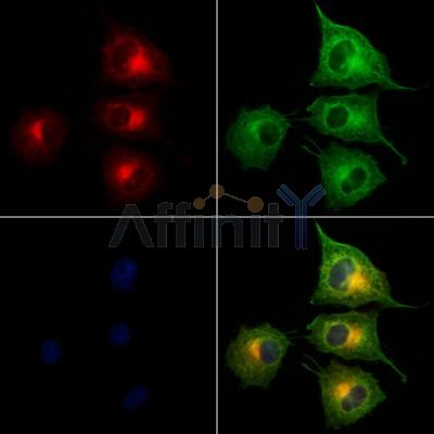 TIMM44 Antibody - DF12332 staining HUVEC cells by IF/ICC.
