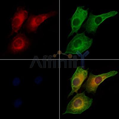 CFHR3 Antibody - DF12363 staining HUVEC cells by IF/ICC.