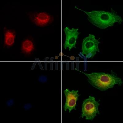 CYPC Antibody - DF12379 staining HUVEC cells by IF/ICC.