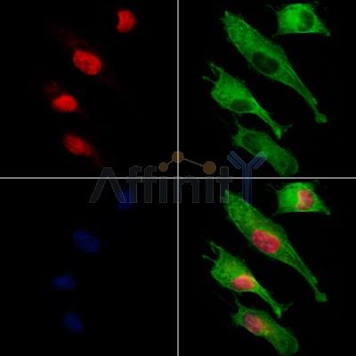 DOM3Z Antibody - DF12385 staining HUVEC cells by IF/ICC.