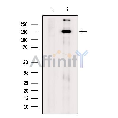 BCL9 Antibody - Western blot analysis of extracts from Mouse  brain, using BCL9 Antibody.