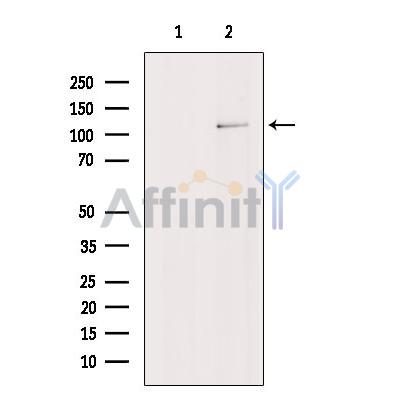 PHF8 Antibody - Western blot analysis of extracts from Hela cells, using PHF8 Antibody.