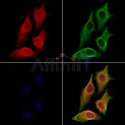 DNase II Antibody - DF13359 staining HepG2 cells by IF/ICC.