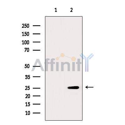 FKBP25 Antibody - Western blot analysis of extracts from RAW264.
