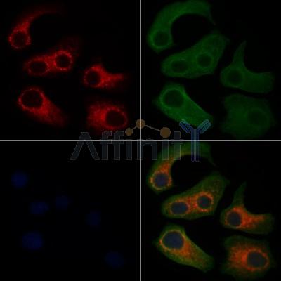 SLIRP Antibody - DF13485 staining HepG2 cells by IF/ICC.