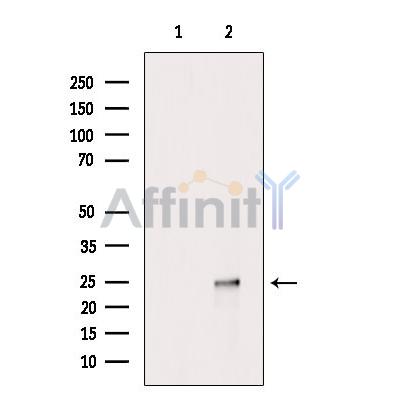 HAND2 Antibody - Western blot analysis of extracts from A2780 cells, using HAND2 Antibody.