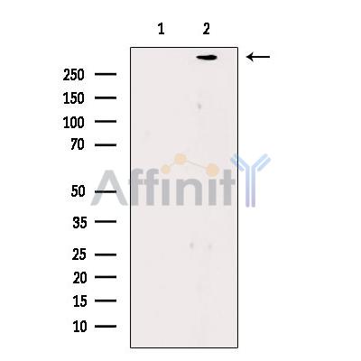 Filaggrin Antibody - Western blot analysis of extracts from Rat eyes, using Filaggrin Antibody.