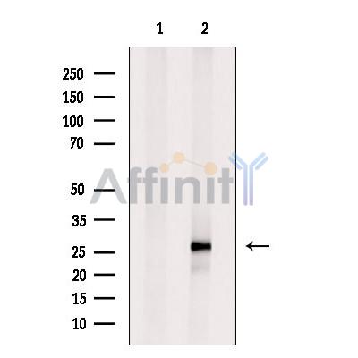DIRAS3 Antibody - Western blot analysis of extracts from MDA-MB-231 cells, using DIRAS3 Antibody.