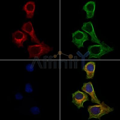 UBE2D3 Antibody - DF2261 staining HepG2 cells by IF/ICC.