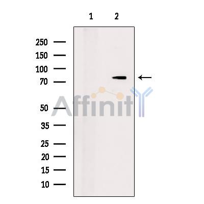 SATB2 Antibody - Western blot analysis of extracts from HepG2 cells, using SATB2 Antibody.