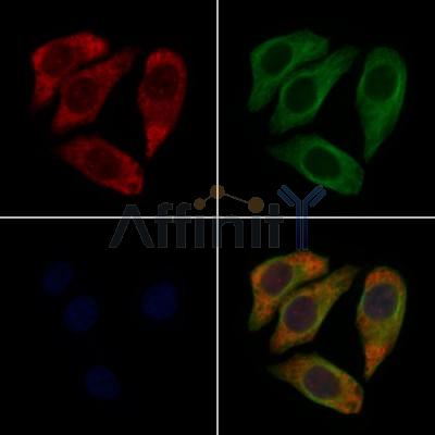 SGCA Antibody - DF3764 staining Hela cells by IF/ICC.