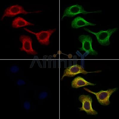 ARSA Antibody - DF3794 staining Hela cells by IF/ICC.