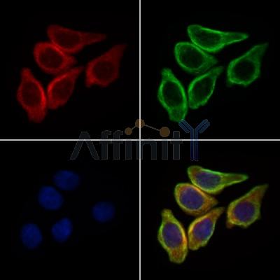 EPN3 Antibody - DF4046 staining HepG2 cells by IF/ICC.