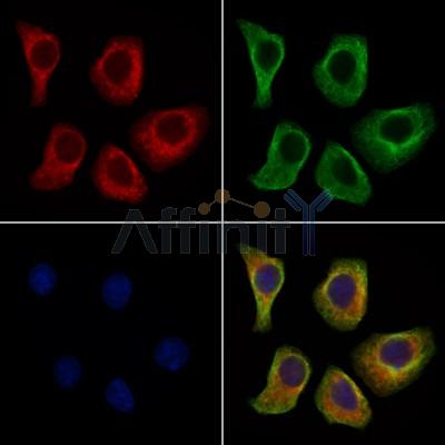 GNL1 Antibody - DF4112 staining HepG2 cells by IF/ICC.