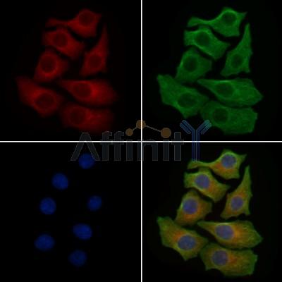 SCFD1 Antibody - DF4450 staining HepG2 cells by IF/ICC.